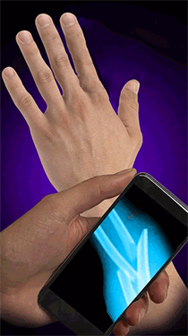 X射線模擬器下載